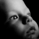 Brno medical opthalmology - baby eyes