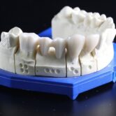 Brno medical dental care - artificial teeth