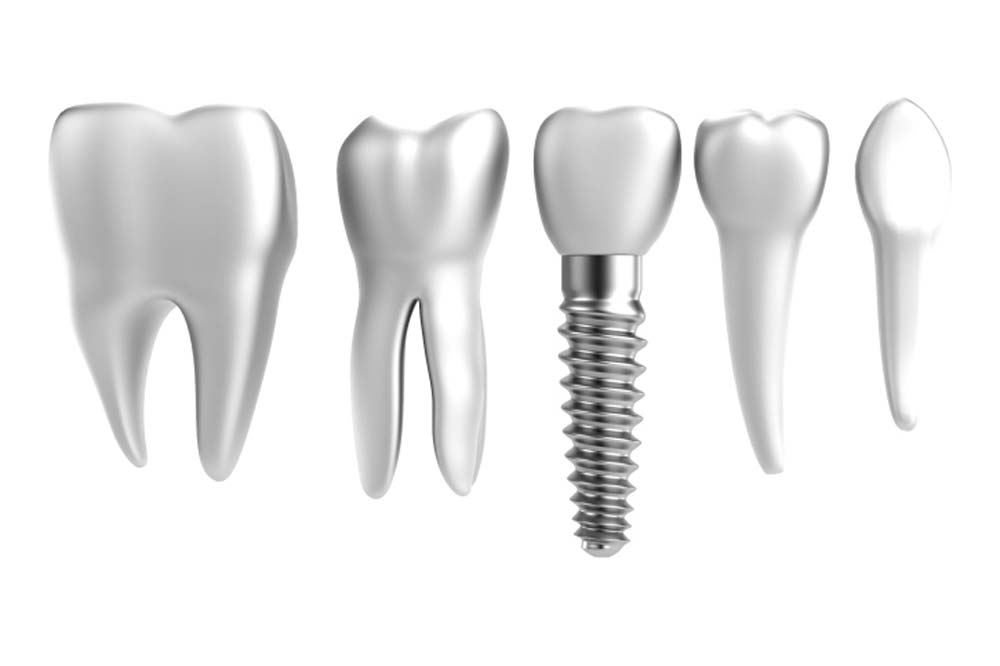 artificial teeth - tooth - dental care Brno