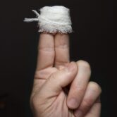 Brno medical - plastic surgery - injured fingers